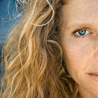 L�ser y Luz Pulsada en el tratamiento de lesiones pigmentarias y vasculares