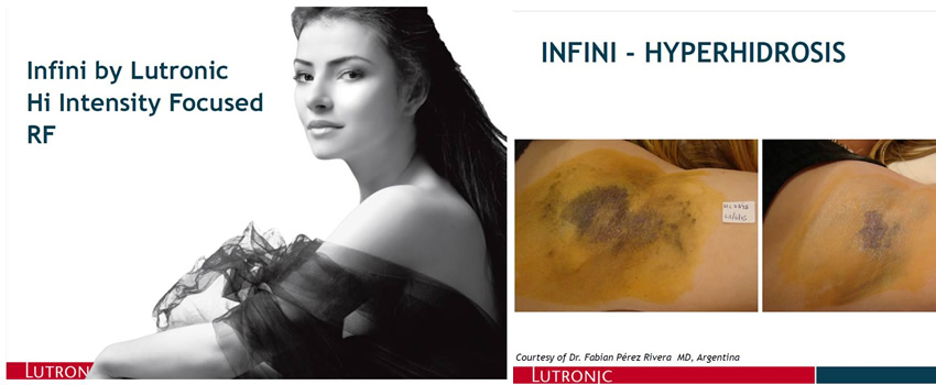 Fotos del Dr. Perez Rivera en Cat�logo mundial Lutronic