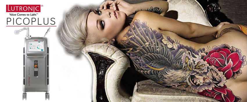 Conoc� c�mo funciona el PicoPlus para borrar tatuajes